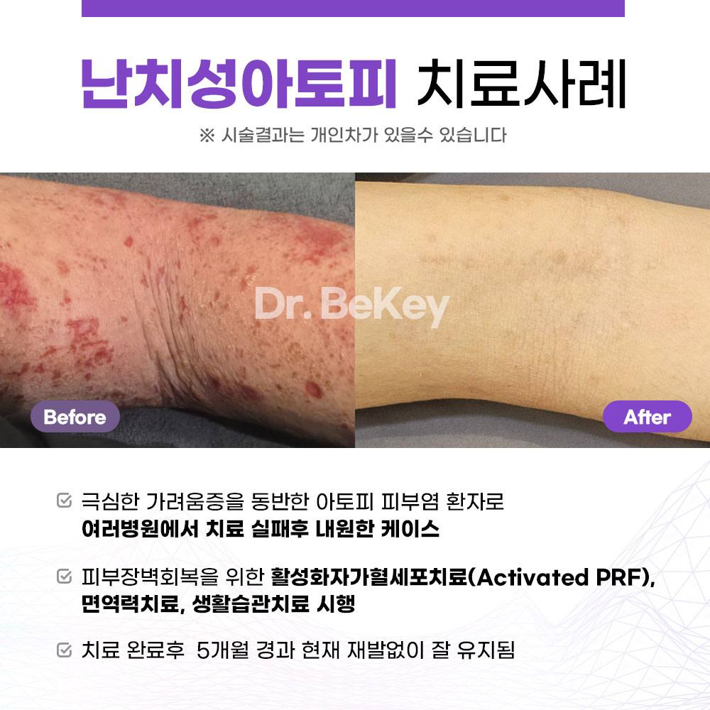 썸네일 2